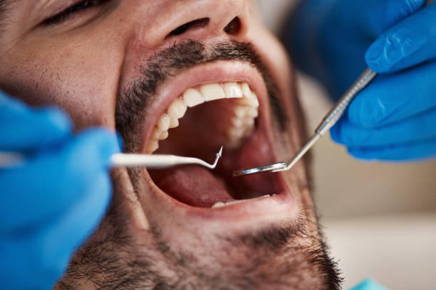 Best Emergency Cosmetic Dentistry (e.g., broken veneers) in Hainesvle, IL