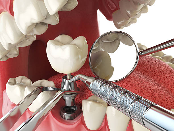 Best Walk-In Emergency Dental Services in Hainesvle, IL