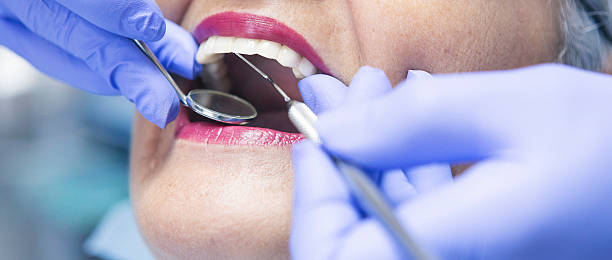 Best 24-Hour Emergency Dental Care in Hainesvle, IL
